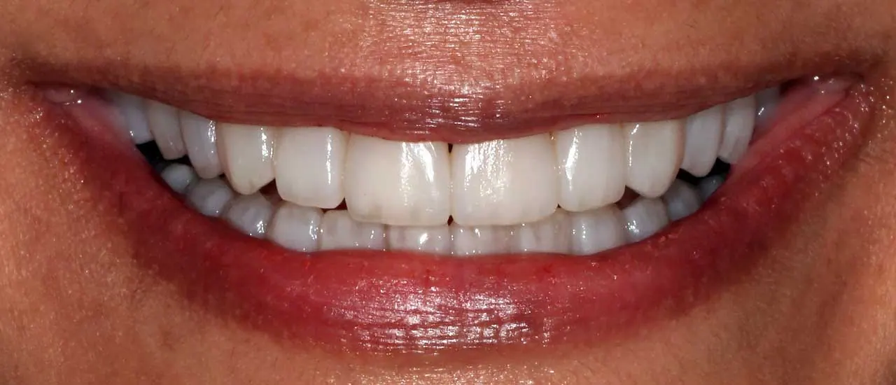 Treatment result