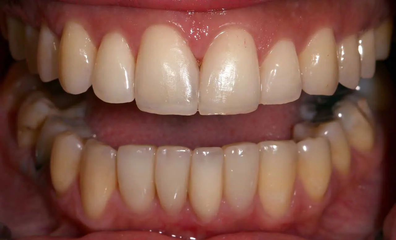 Treatment result