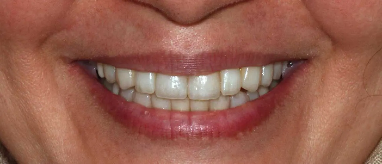 Treatment result