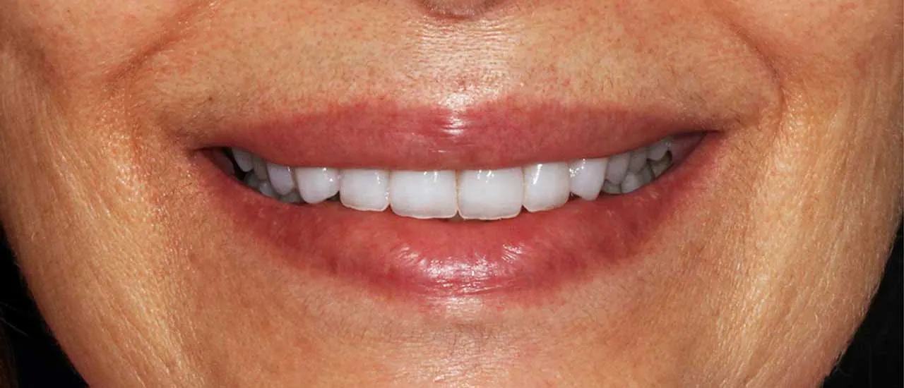 Treatment result
