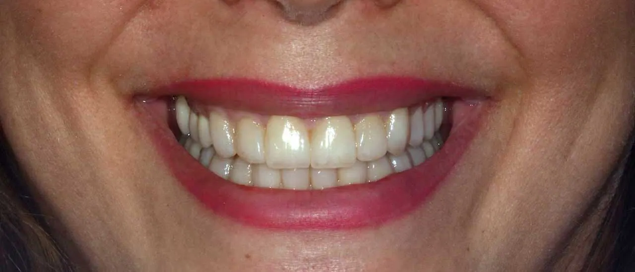 Treatment result