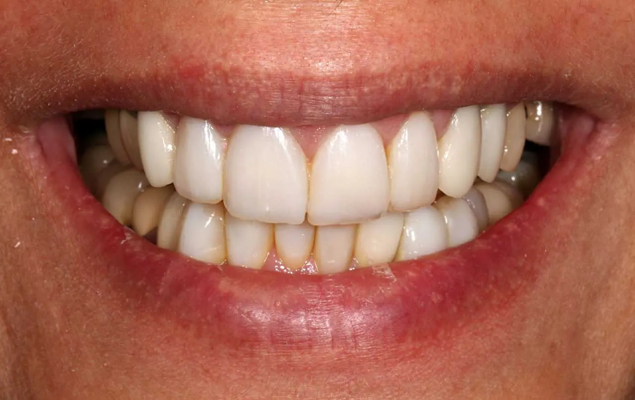 Treatment result