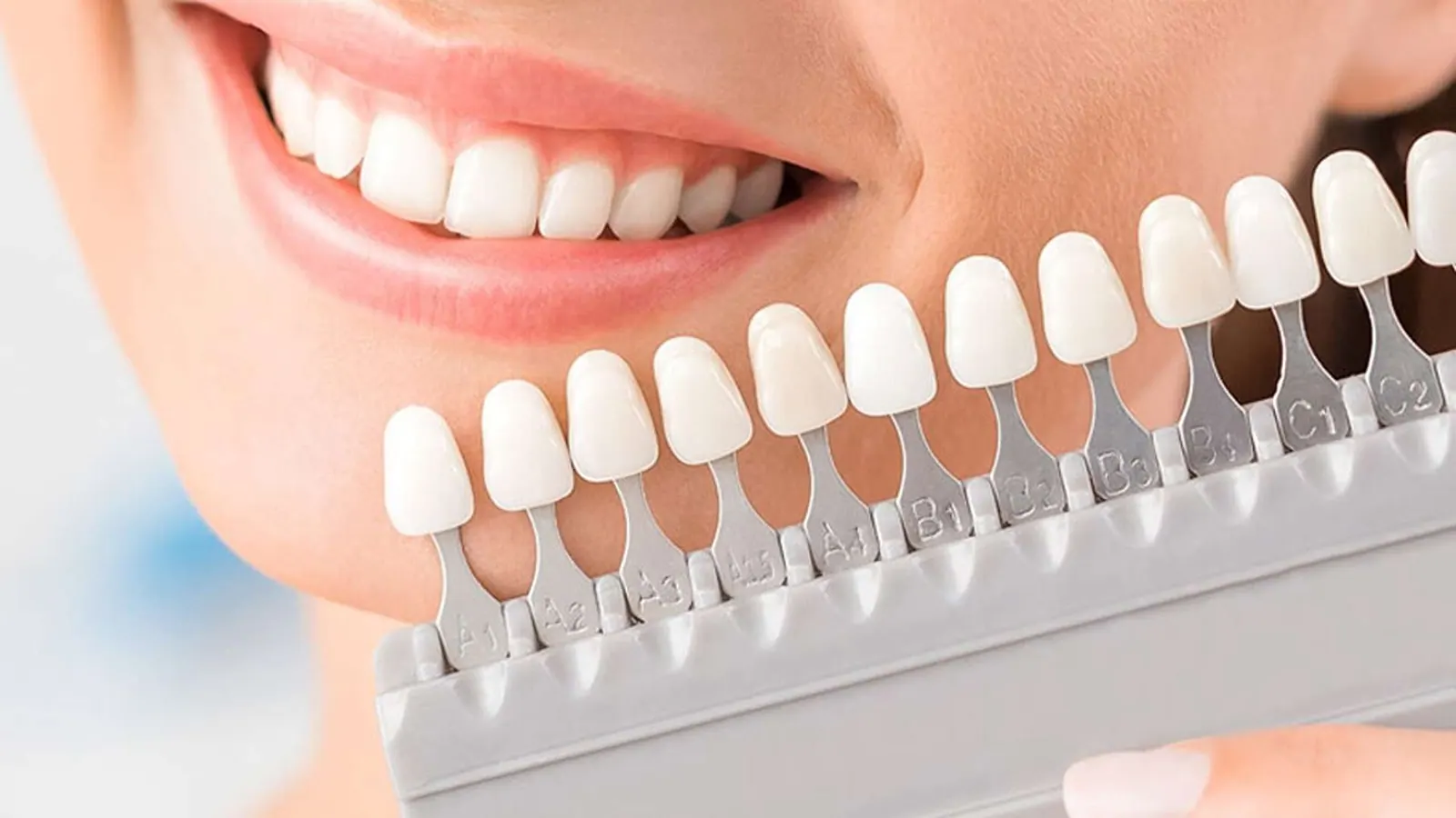 چه مقدار تراشیدن دندان برای لمینت انجام میشود؟ + نحوه انجام