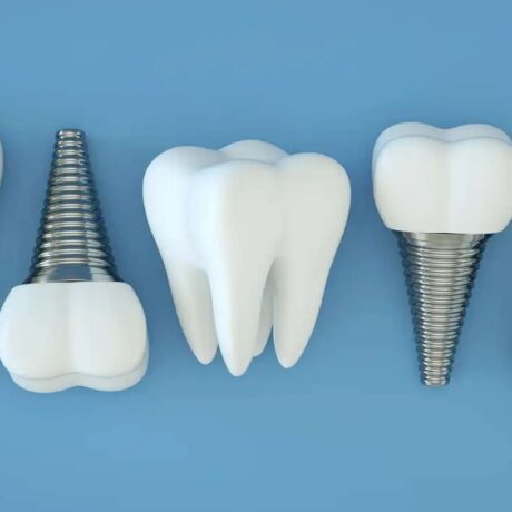 اگر پیج ایمپلنت بیفتد چه کنیم؟ دلایل و راه‌های پیشگیری