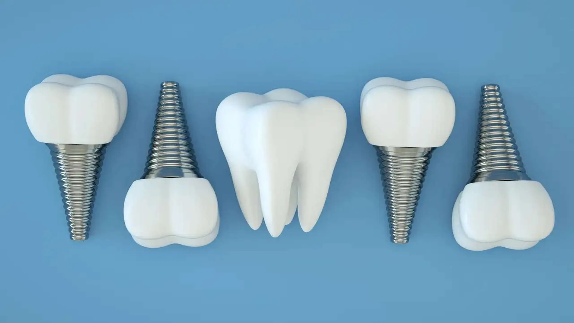 اگر پیج ایمپلنت بیفتد چه کنیم؟ دلایل و راه‌های پیشگیری