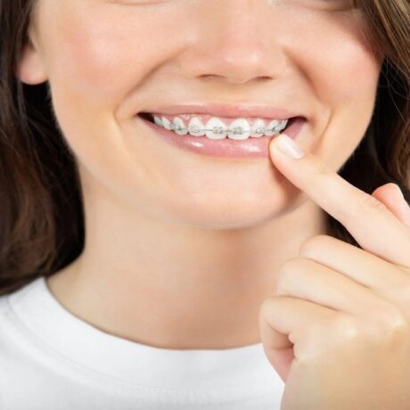 همه چیز درباره صاف و مرتب کردن دندان بدون ارتودنسی + مزایا و معایب