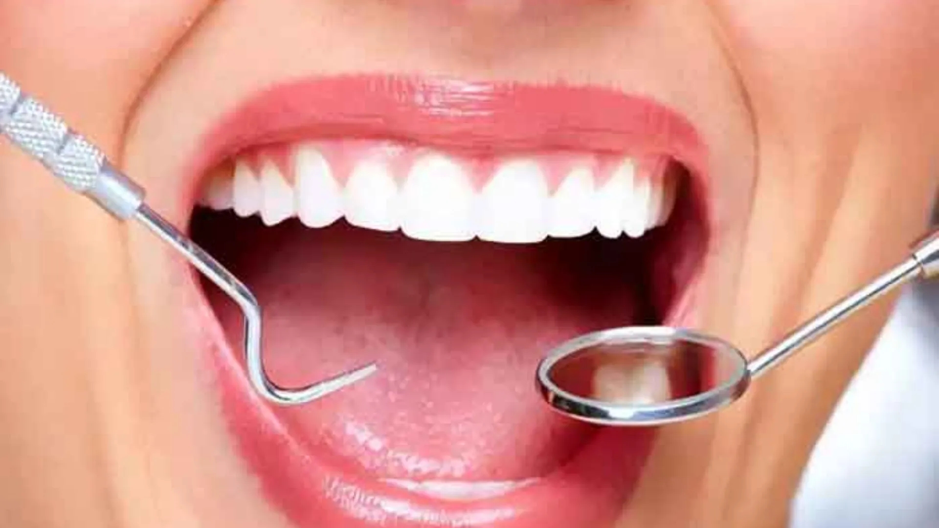 چند ساعت بعد از پانسمان دندان نباید چیزی خورد؟ + راهنمای کامل