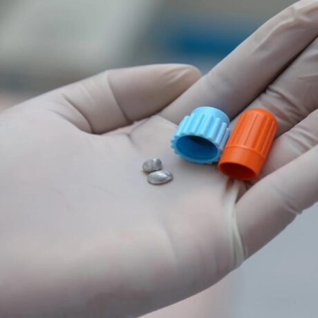 آمالگام چیست و چه کاربردی در دندان پزشکی دارد؟