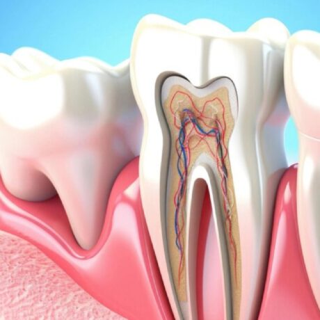 عفونت دندان را جدی بگیرید: از علائم تا درمان عفونت دندان