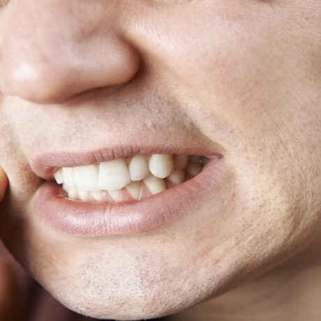 دندان قروچه را جدی بگیرید: راهنمای کامل برای پیشگیری و درمان